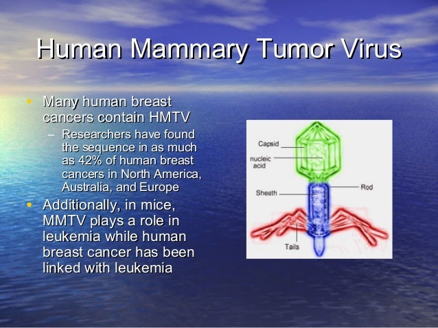 breast cancer that is a virus Breast cancer that is a virus